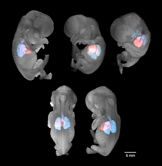 56 Day Human Embryo