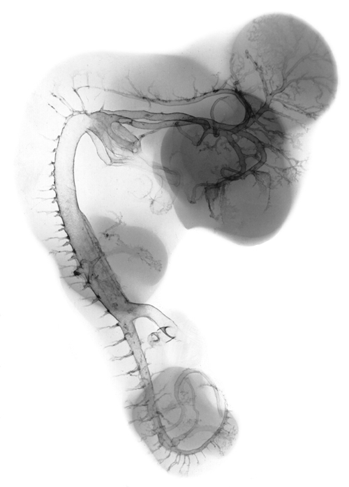 5 Day Chick Embryo