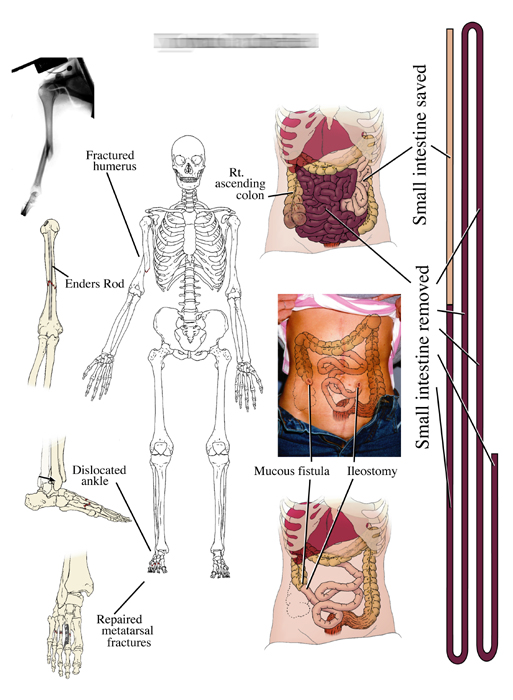 Medial-legal Exhibit