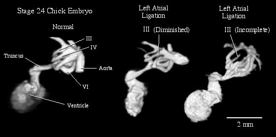 MRIs of Normal and Altered Chick Embryo Hearts