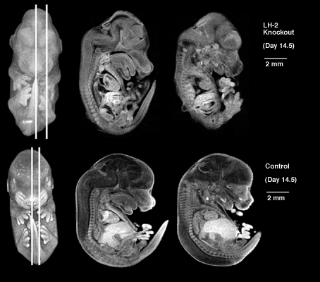 LH-2 Knockout mouse embryo image
