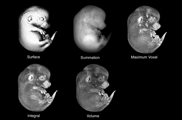 MRI rendering methods image